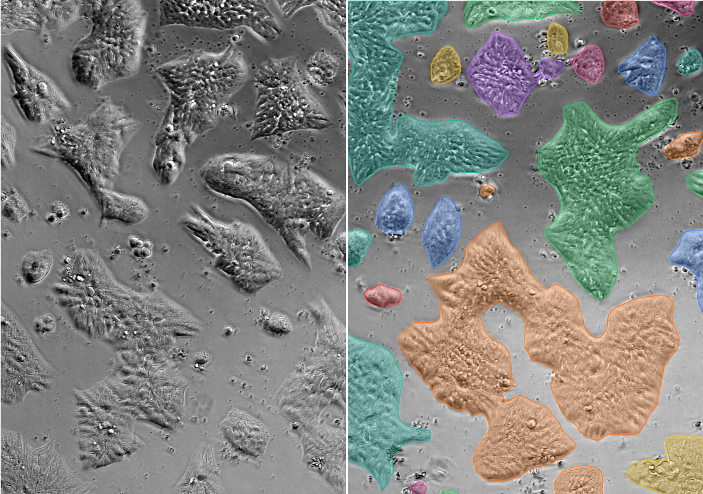 Label-free colony detection showing raw microscopy image and automated colony identification with confluence analysis