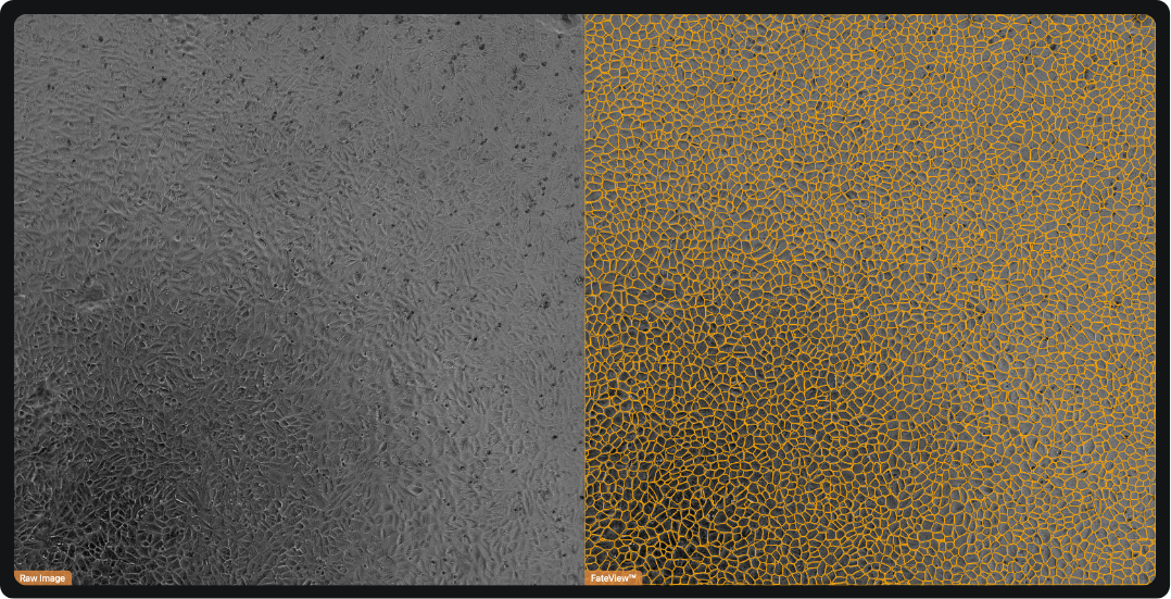 Raw label-free RPE image and FateView™ readout showing single-cell detection and counting.